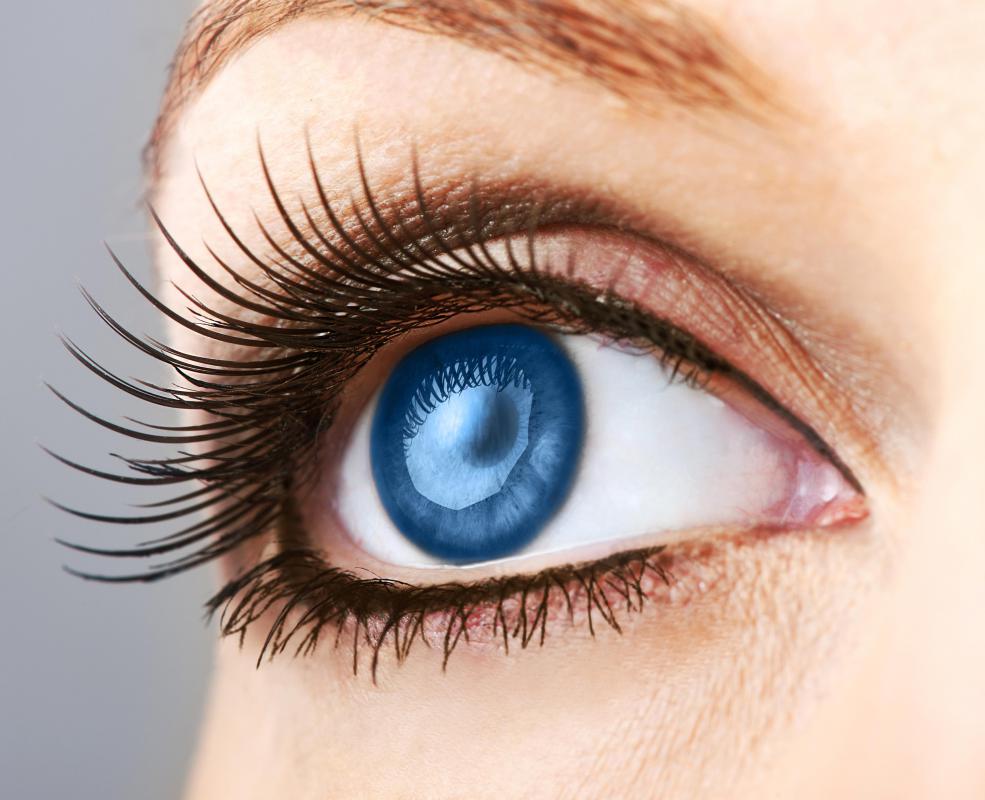 An individual with TIA will experience changes in vision.