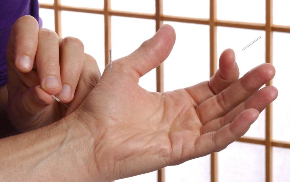 Snoring rings rely on the same meridans used in acupuncture.
