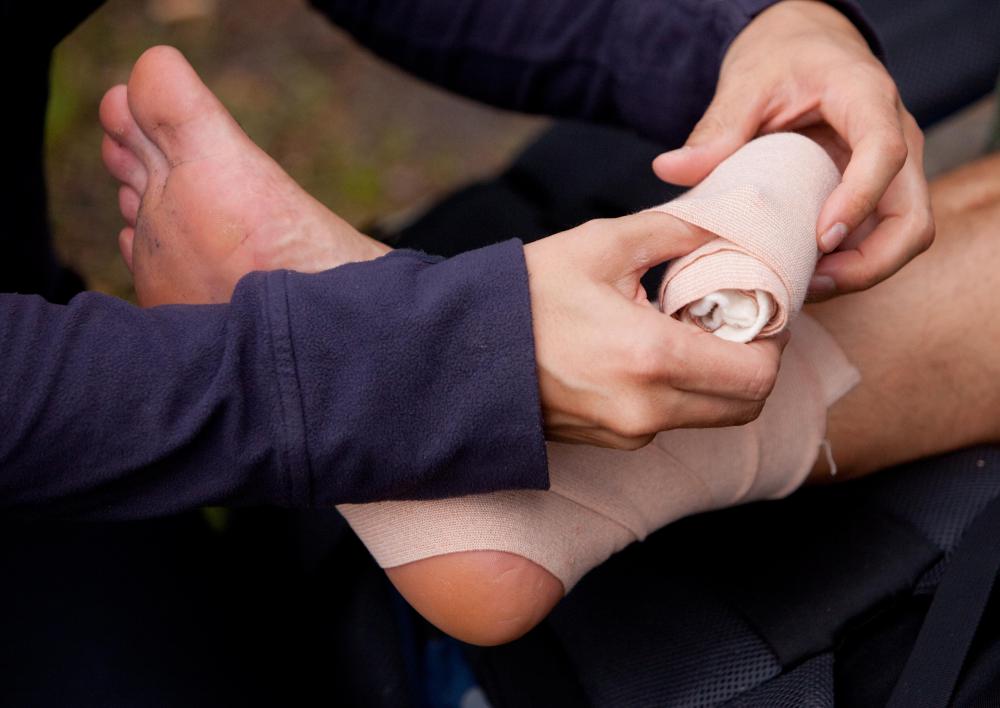 Broken ankles usually occur when people twist their ankles.