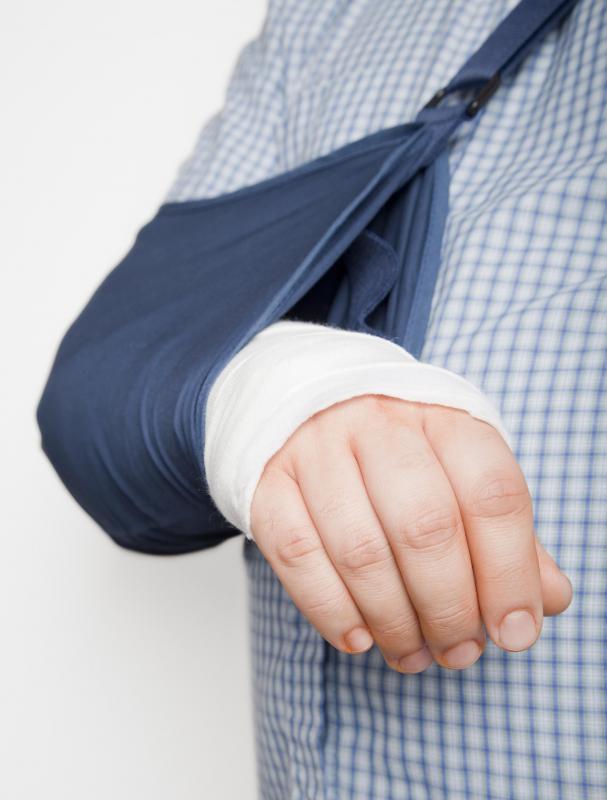 Some types of radial head fractures are treated with a cast or splint and sling.