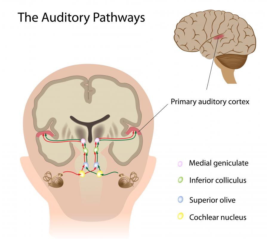 Auditory processing disorder may be caused by a problem in the auditory pathways.