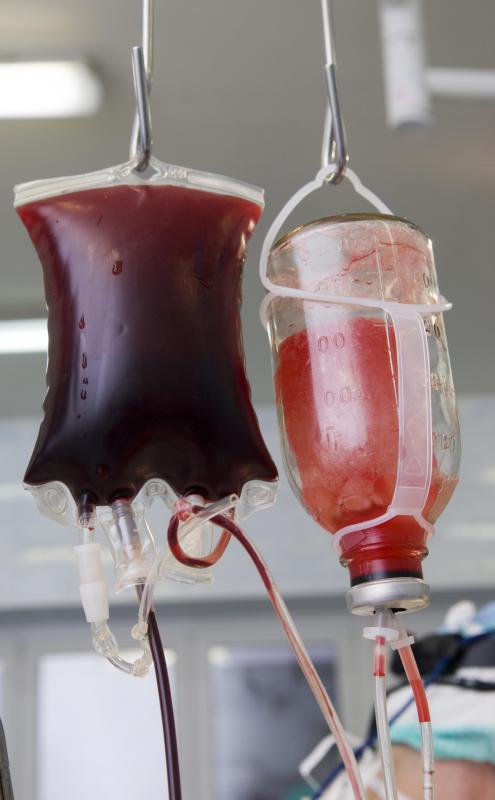 Antihistamines can be used to treat hives and itching associated with an allergic reaction to a blood transfusion.