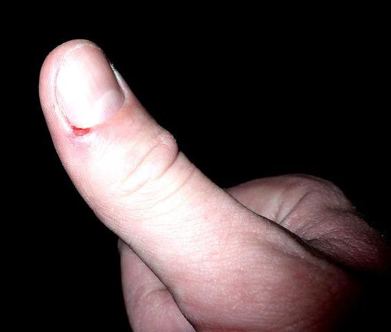 Adhesive bandages may be used to cover tiny wounds like hangnails.