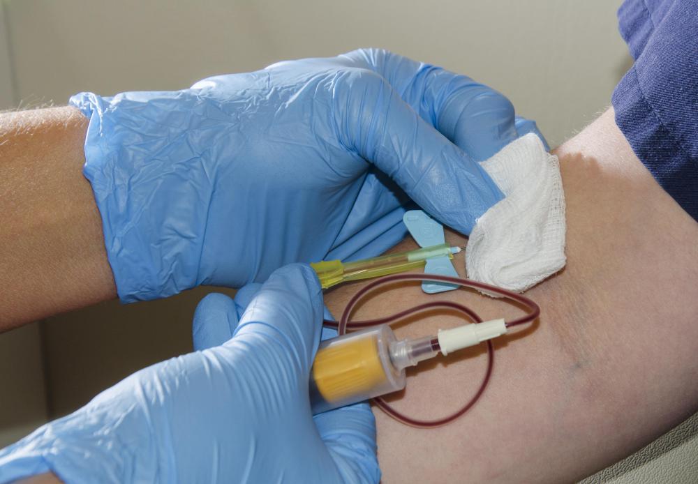 Conducting a creatinine blood test requires a blood sample to be extracted from a vein in the arm.