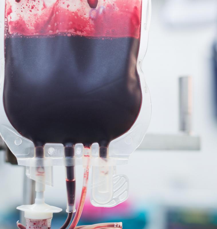 A blood transfusion is one kind of intravenous drip.