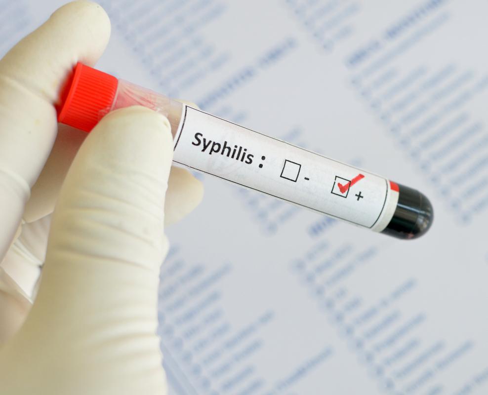 Syphilis is commonly treated with penicillin shots, with the number of required shots determined by length of infection.
