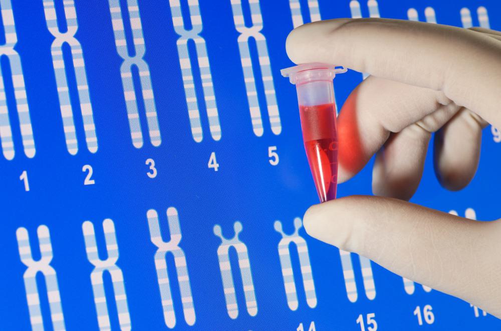 Genetic testing can confirm the presence of an extra chromosome.