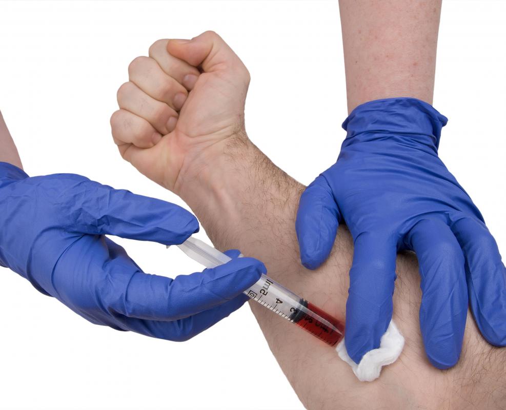 Blood may be drawn to test monocyte levels.