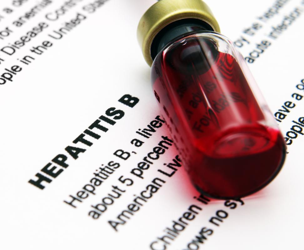 The Australia antigen was an important factor in creating the hepatitis B vaccine.