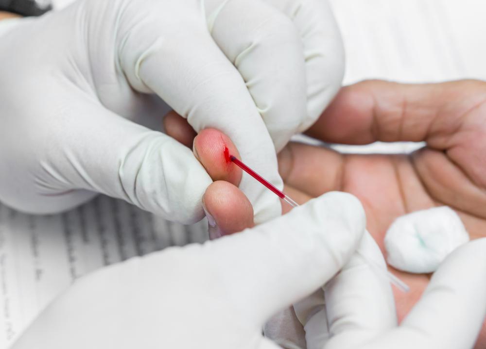 A creatine blood test is a blood examination that checks the level of creatine in the kidneys.