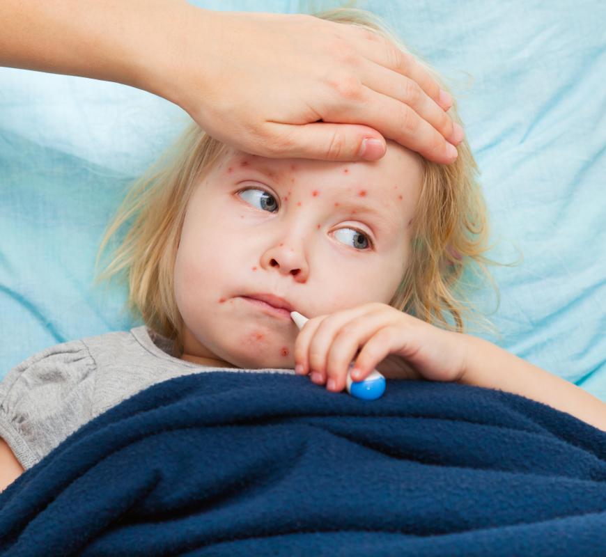 Measles may cause nephritis.