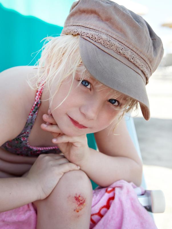 Kids who play team sports are more likely to suffer scrapes and other minor injuries.