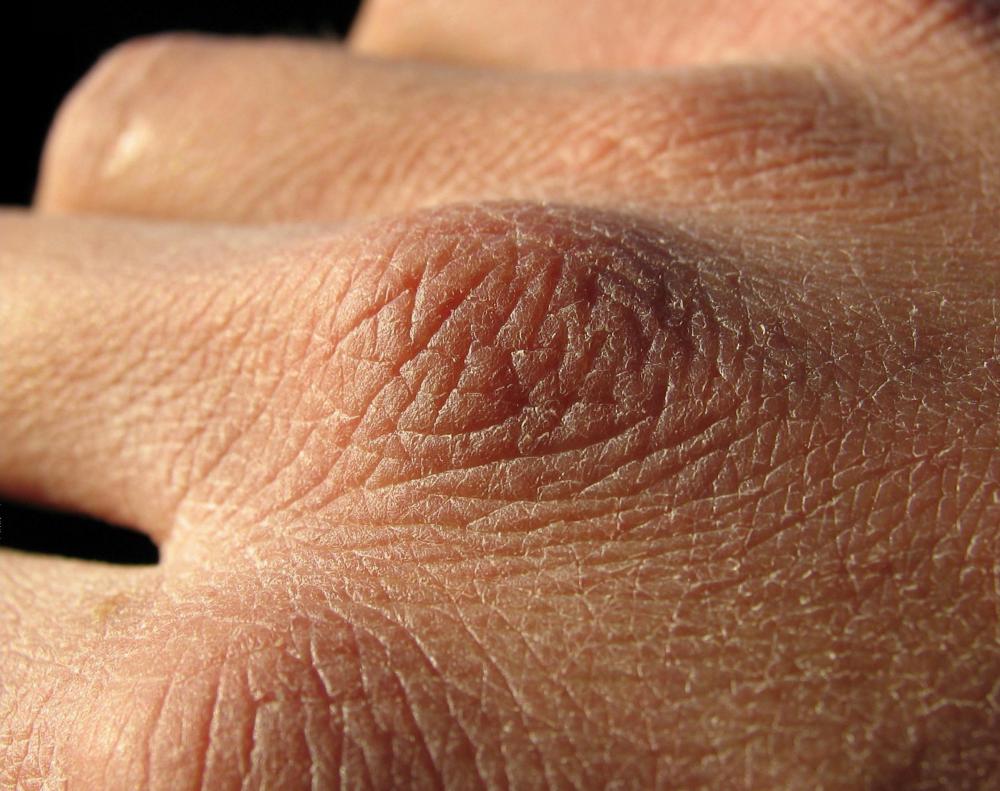 Many people apply lecithin topically to moisturize dry skin.