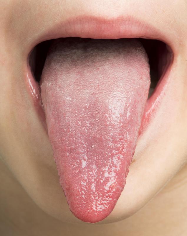 Dysgeusia causes a strange taste in the mouth.