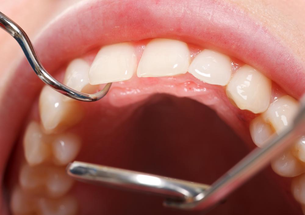 A fear of going to the dentist is considered irrational by some people.