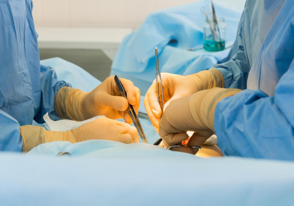 Surgery may be required to treat a simple fracture.
