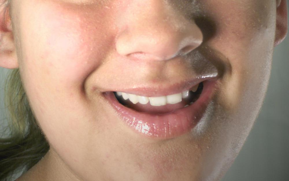 An increase in saliva production may be noticeable during pregnancy.