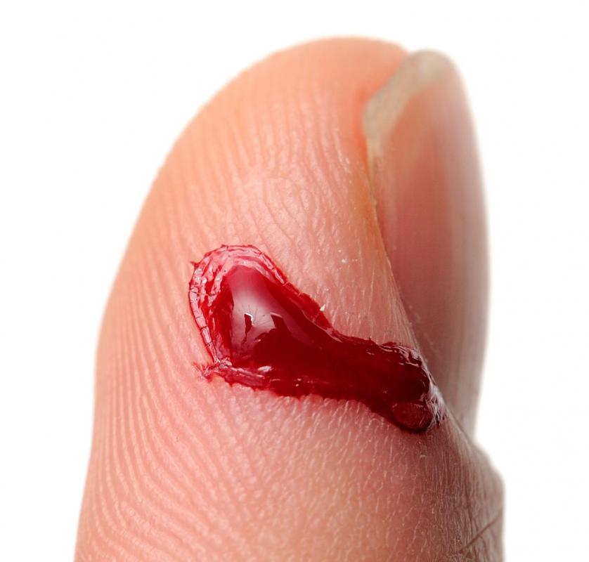 Fibrin is important to the process of blood coagulation.