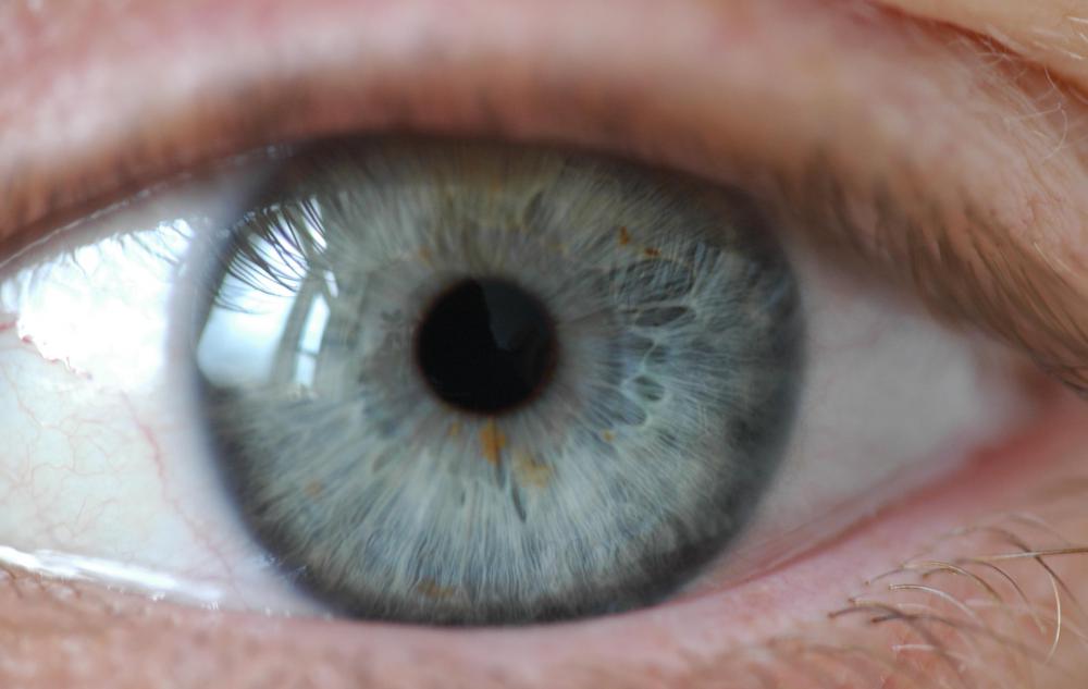 Normally, a person's pupils contract when light is bright.