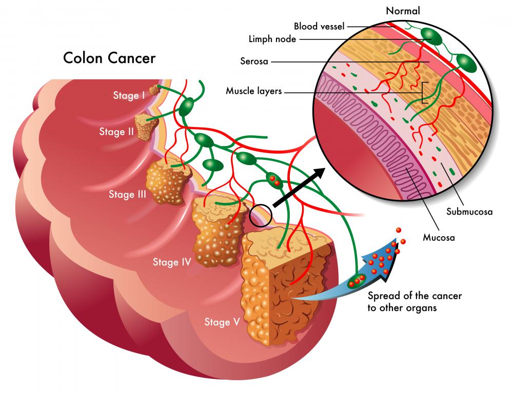 The s-shaped sigmoid colon begins at the end of the descending colon.