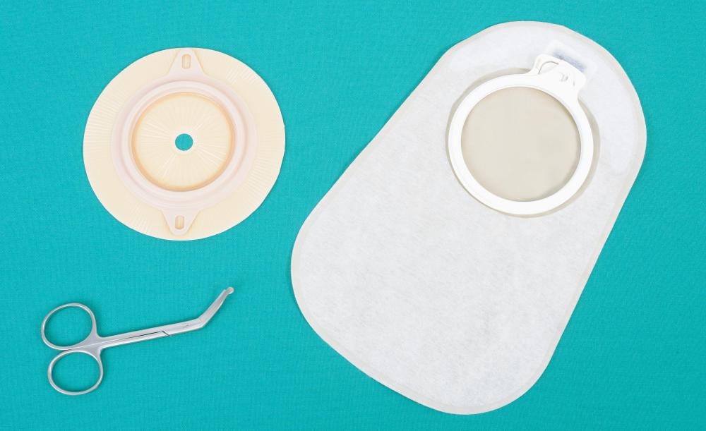 A colostomy bag is a removable and disposable bag used to collect waste from an individual who has undergone a colostomy.