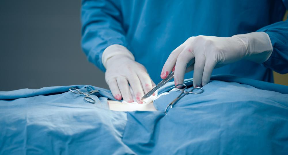 Surgical incisions will always cause pain because they cut through skin, and sometimes nerves, tissues, and muscles as well.