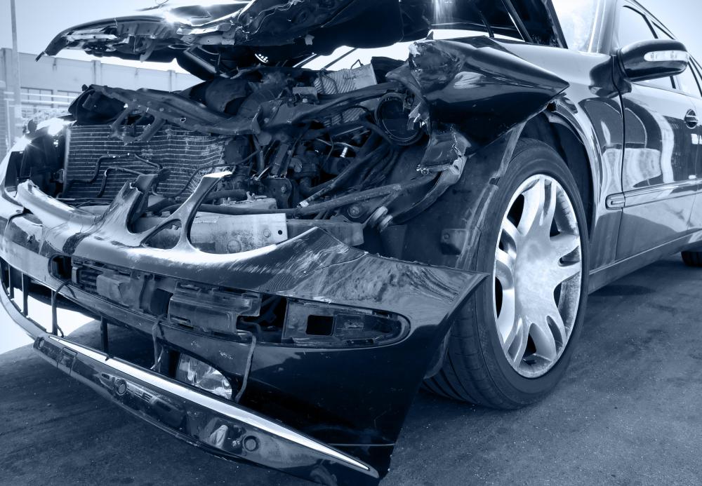 A transfemoral amputation may occur as the result of a car crash.