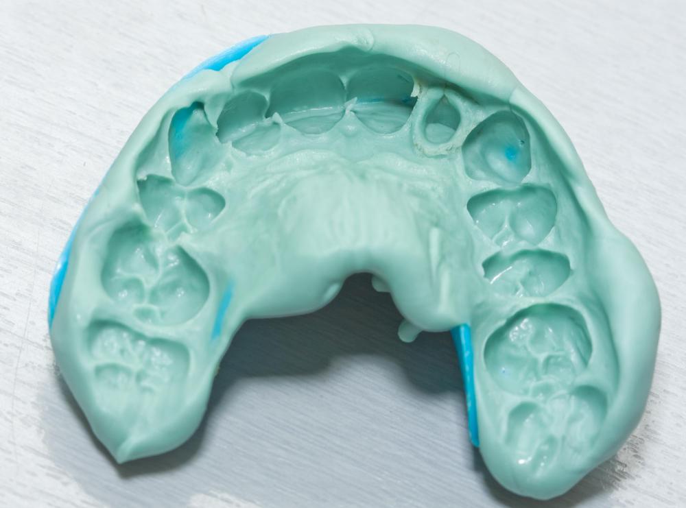A dental impression is made to create mouth guards to protect the teeth.