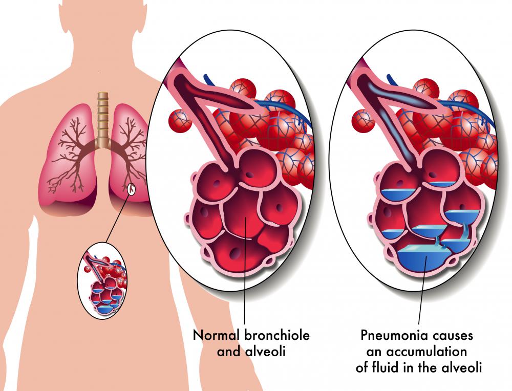 Water in the lungs is an unpleasant sensation.