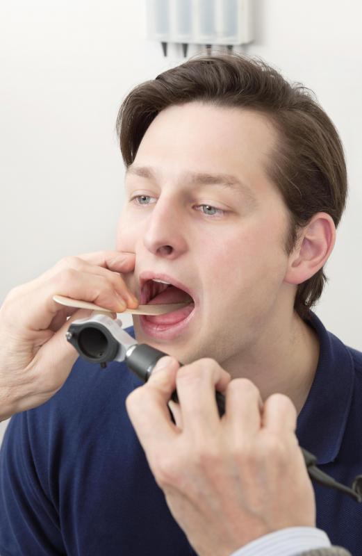 A doctor will need to look into a patient's throat if tonsil cancer is suspected.