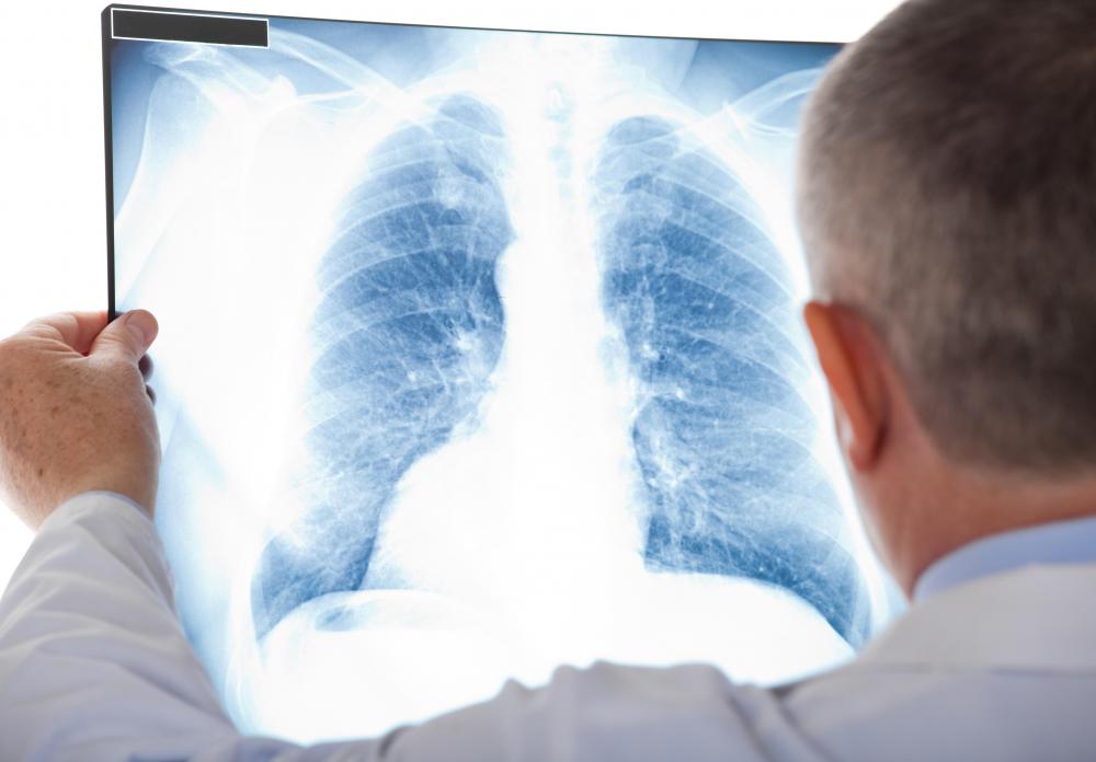 Complications of intubation may include the development of pneumonia.