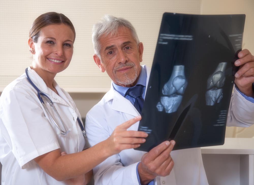 A bone that has broken into several small sections in close proximity is considered a comminuted fracture.