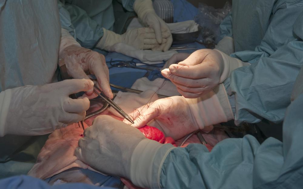 Studies show that people in need of heart surgery are more likely to also have dental problems.