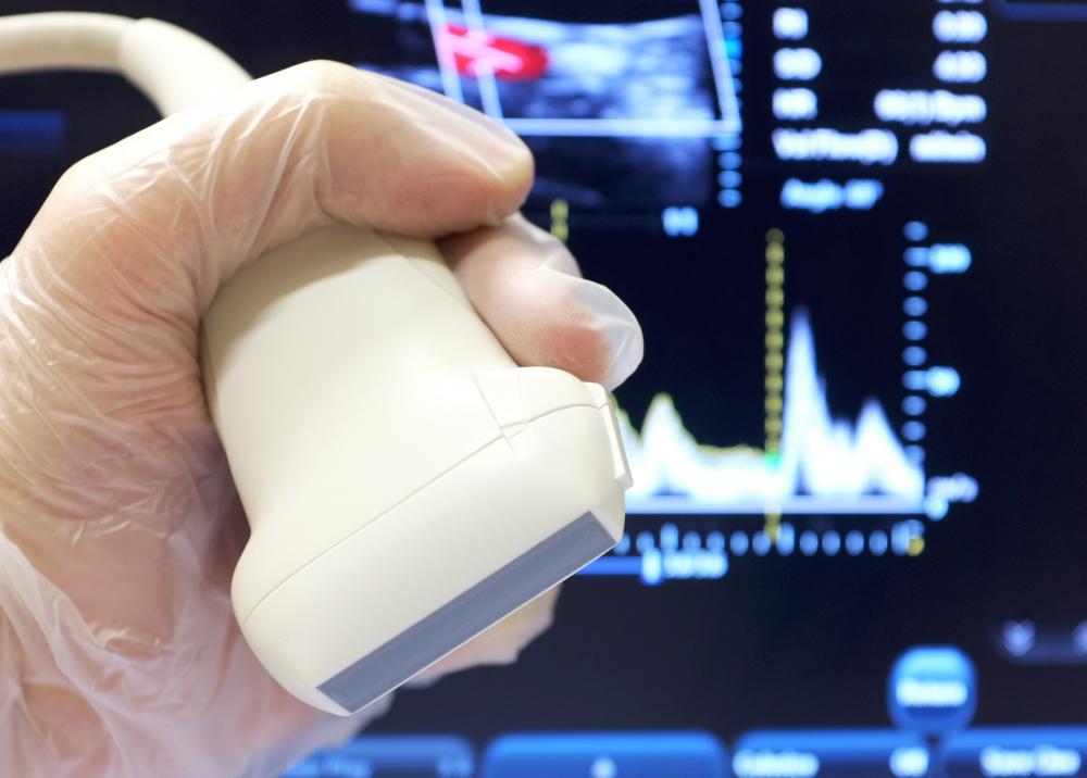 A patient suspected of having hypoperfusion will likely undergo a Doppler ultrasound to confirm the diagnosis.