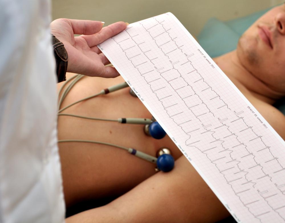 Medical professionals can analyze ECG printouts to diagnose a variety of conditions.