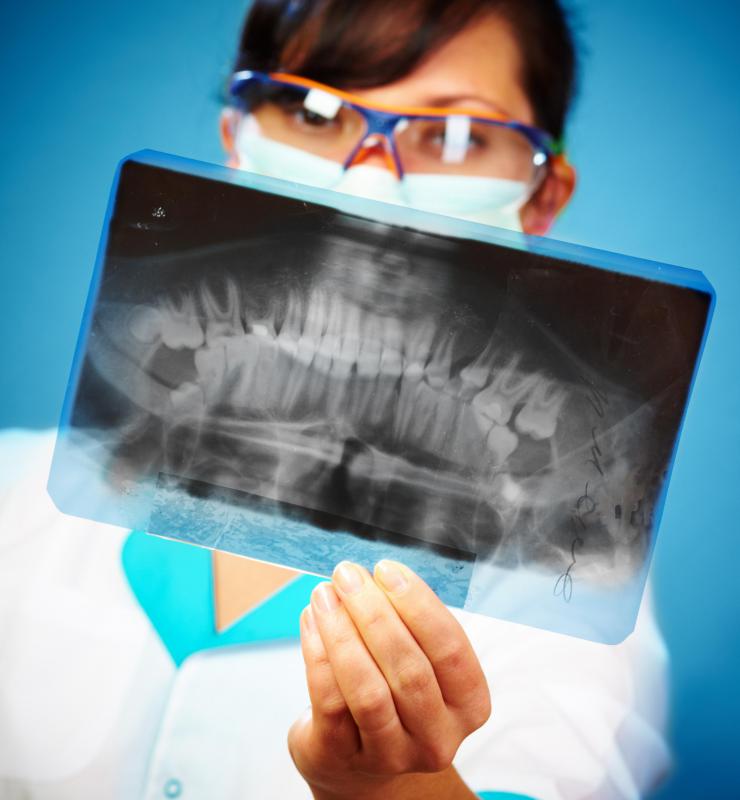 X-rays may help a dentist determine the damage caused by teeth-grinding.