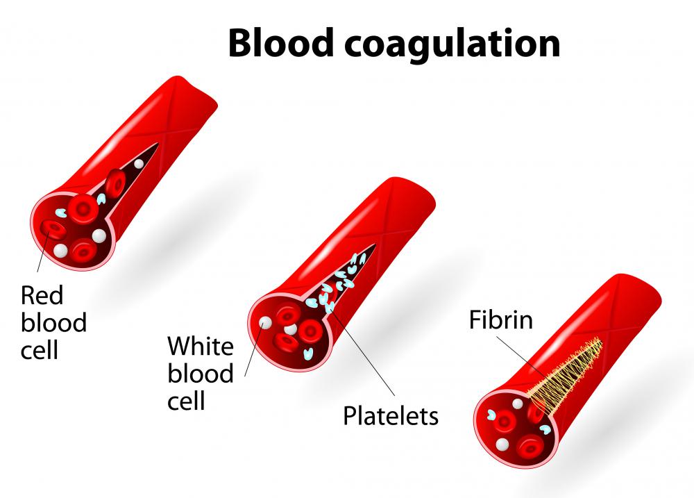 Fibrin combines with platelets and blood cells to create a clot.