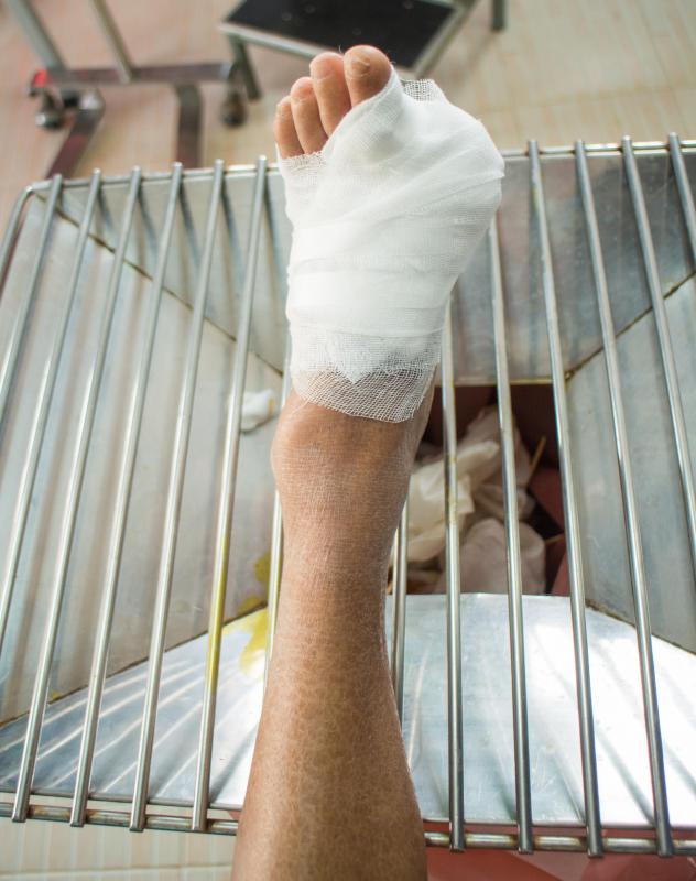 A transmetatarsal amputation is more extreme than a toe amputation.