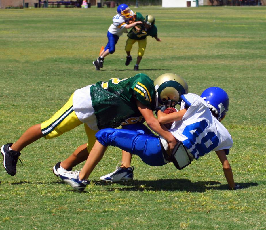A breast bone fracture may occur in sports.