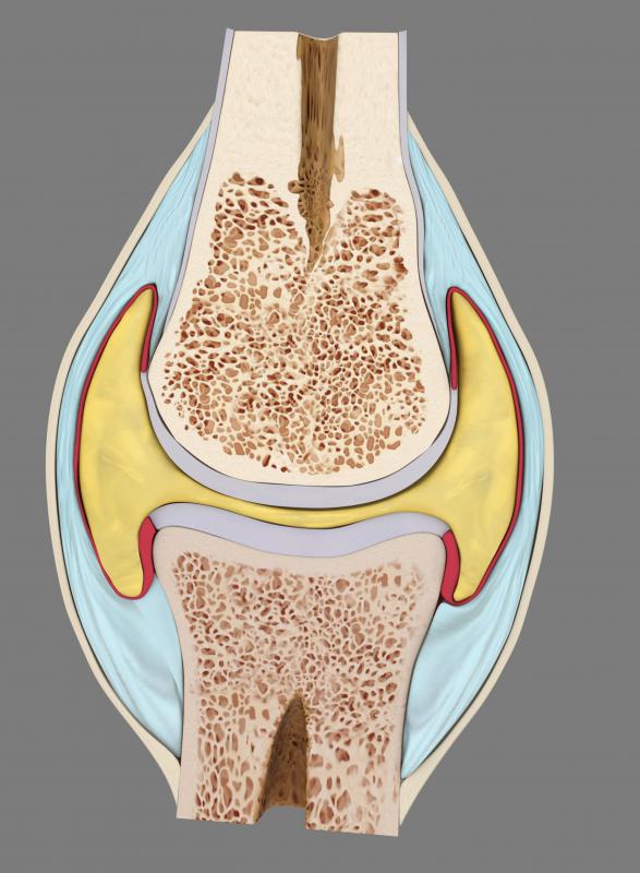 A cartilaginous immovable joint is when bones are joined together with cartilage.