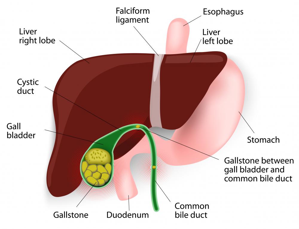Lipotropics help dissolve cholesterol, thus reducing the development of gallstones.