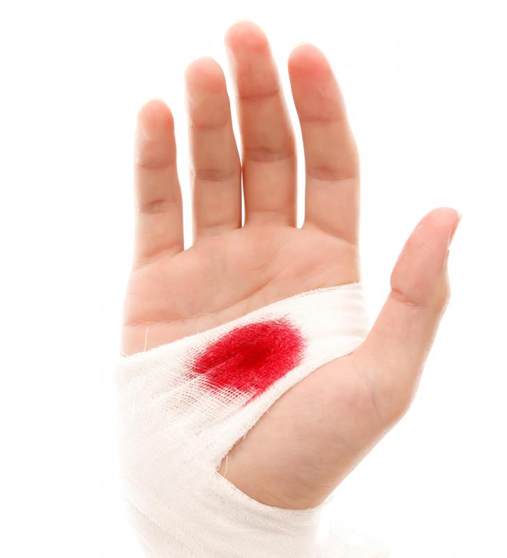Rolled gauze can be used to protect wounds and stem bleeding.
