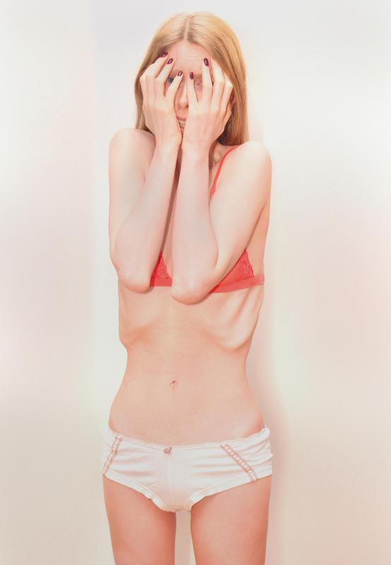 Starvation mode might be caused by an eating disorder.