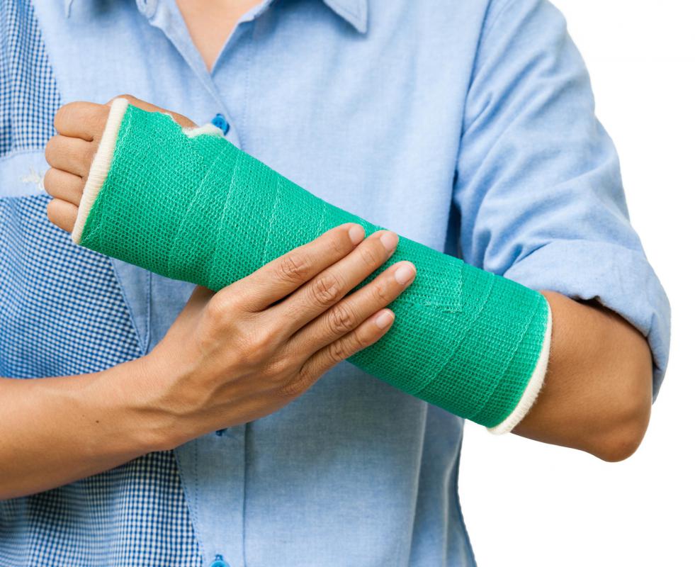 Fiberglass casts require less maintenance than casts made from plaster.