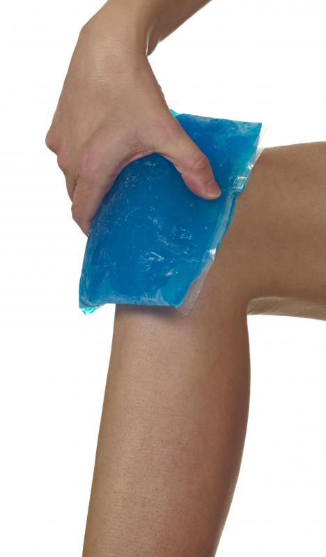 Gel ice packs can be contoured slightly to the bend of the knee, which makes them ideal for treating the swelling around the fracture.