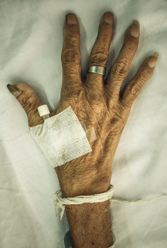 The hand contains several tendons that connect bone, muscle, and cartilage tissue.
