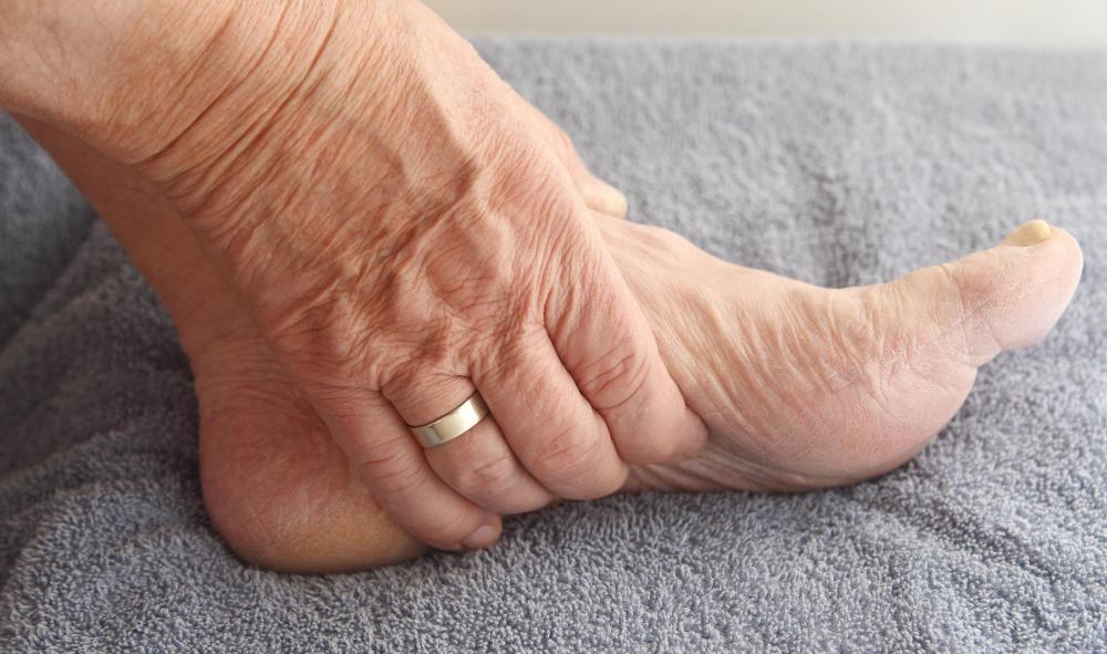 The saphenous veins meet in the dorsal venous foot arch.