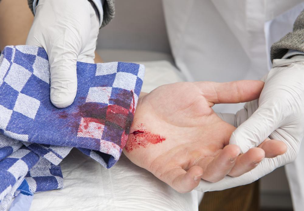 A bruised hand may be accompanied by a break in the skin.