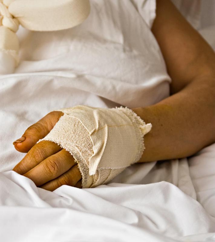 Improper dressing of wounds may delay wound healing.