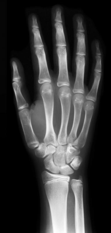 An X-ray, a type of medical imaging.